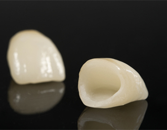 Dentus bemetale keramika