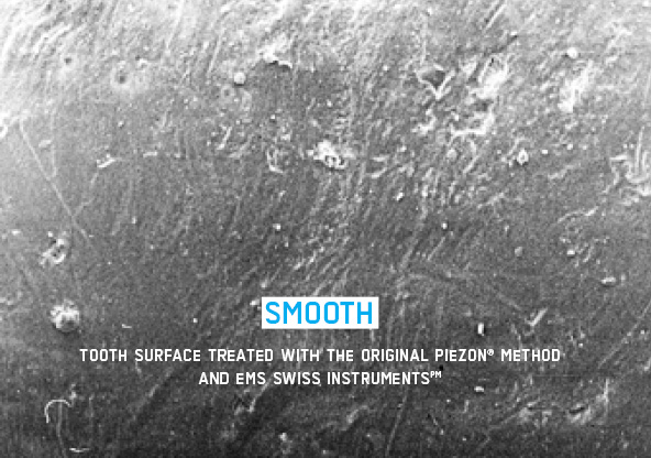 Smooth-surface_FA-322_original